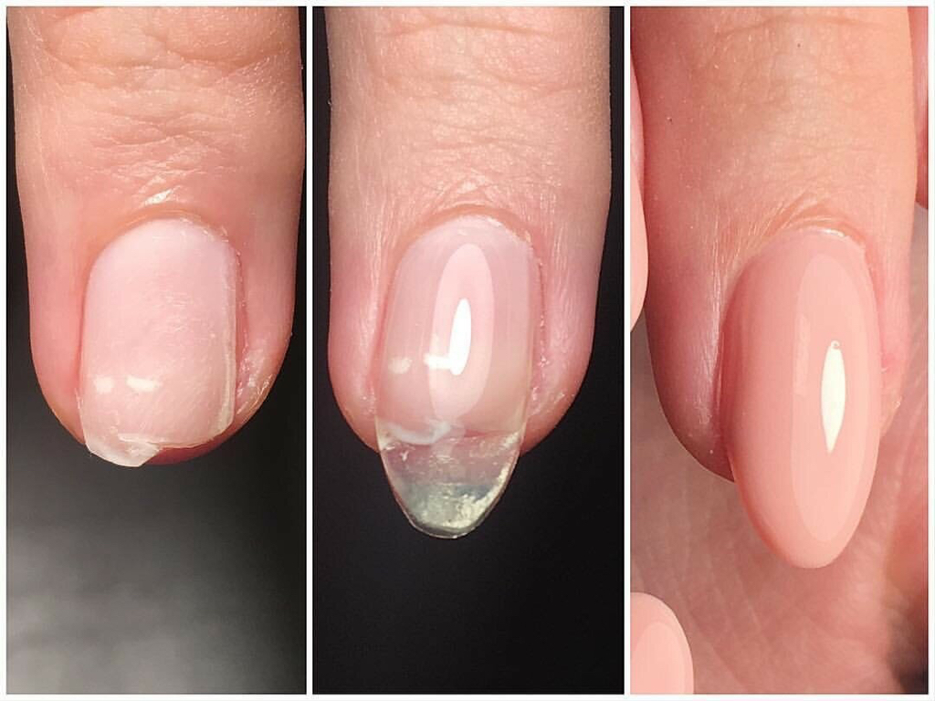 💅Сложный РЕМОНТ ногтя [донаращивание]
