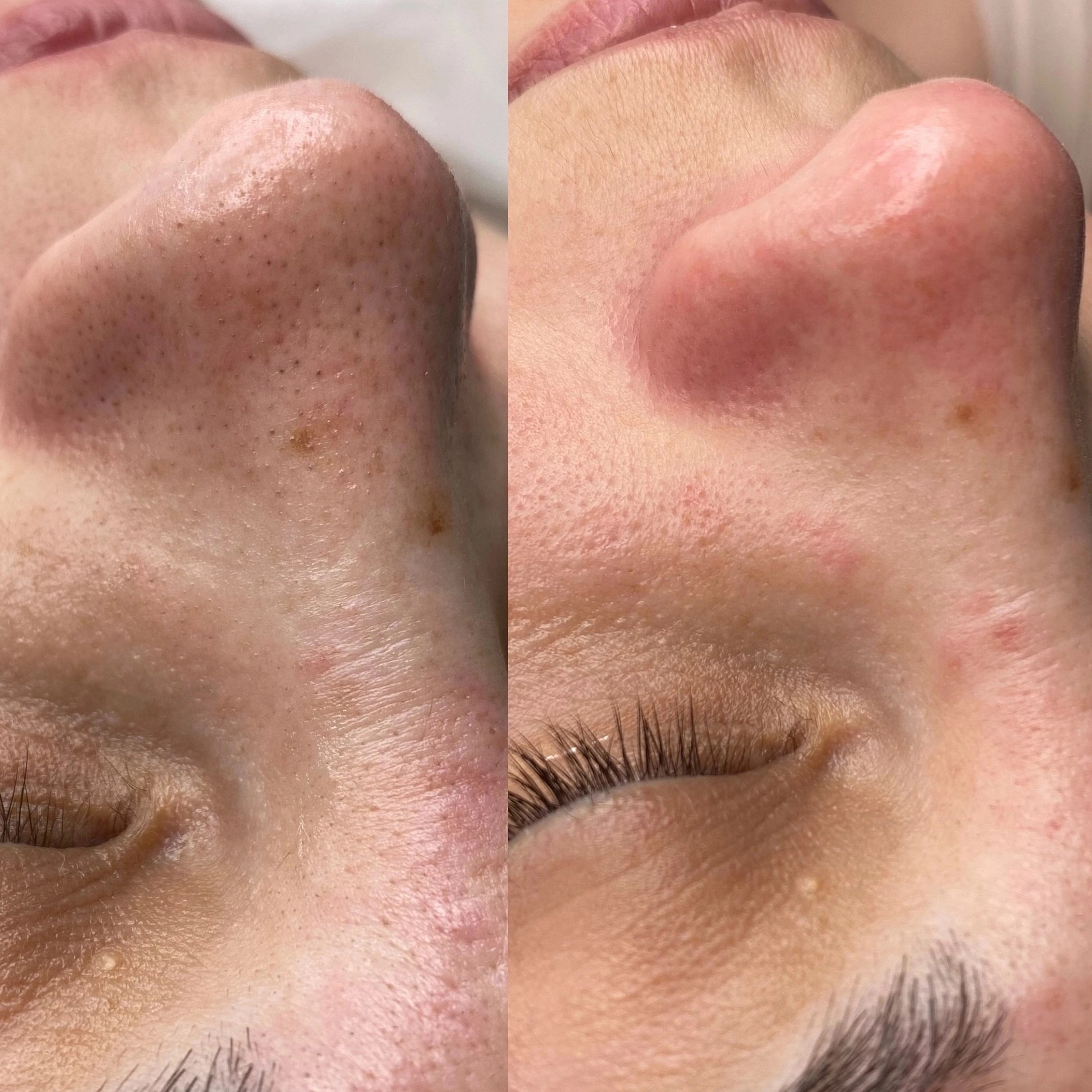 «СИНЕРГИЯ ЧИСТОТЫ»