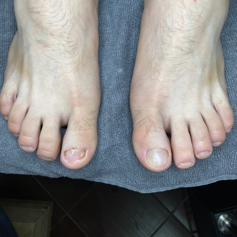 Мужской педикюр