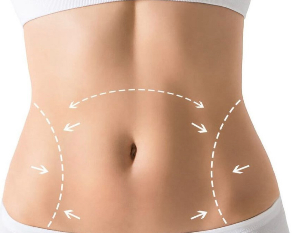 Женщины: 
V lift живот полностью