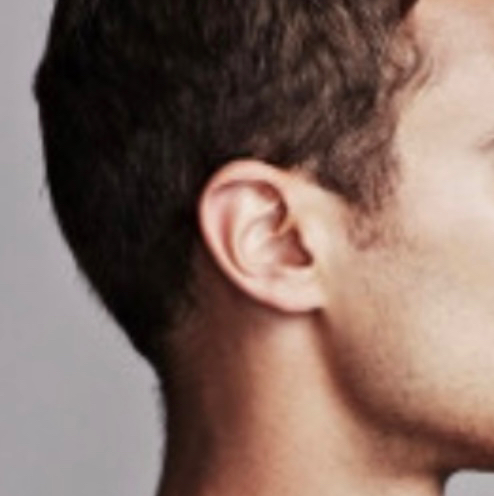 Мужчины: 
Эпиляция: 
Ушные раковины (уши)