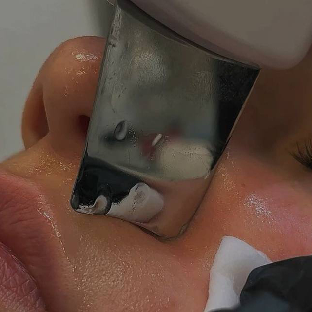 Ультразвуковая чистка лица