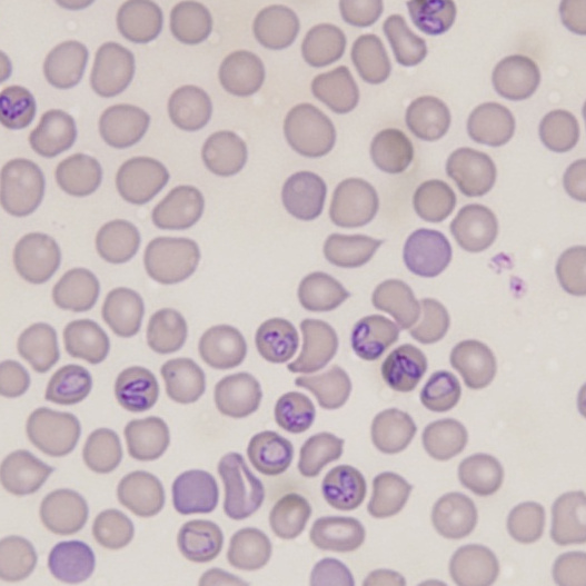 Взятие мазка на пироплазмоз