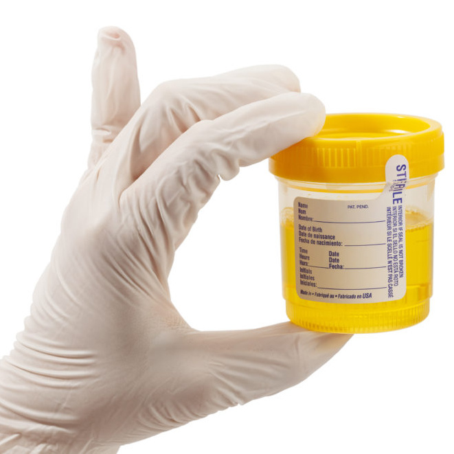 Бак посев мочи