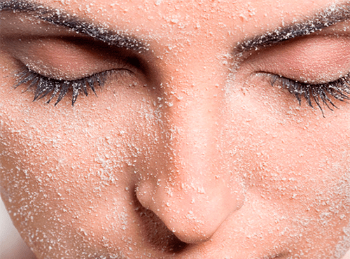 МИКРОДЕРМАБРАЗИЯ