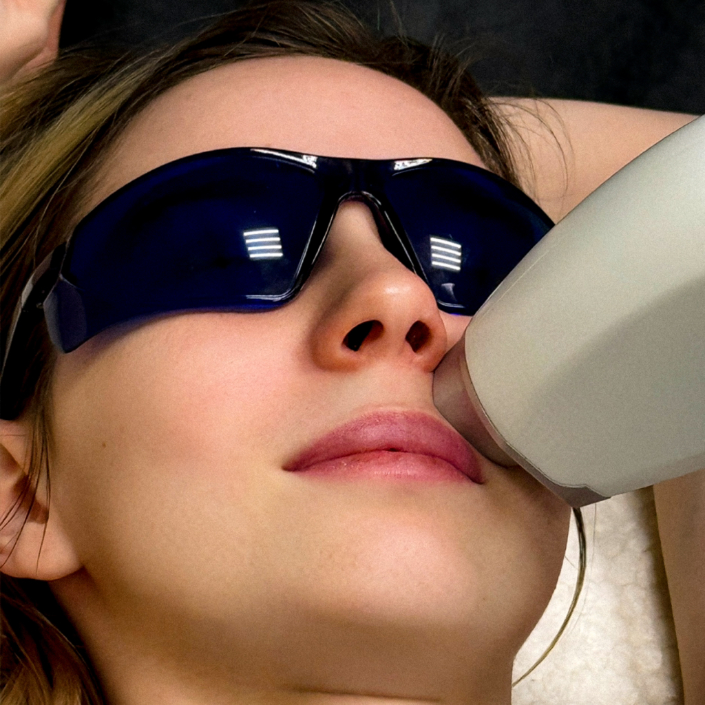 Верхняя губа