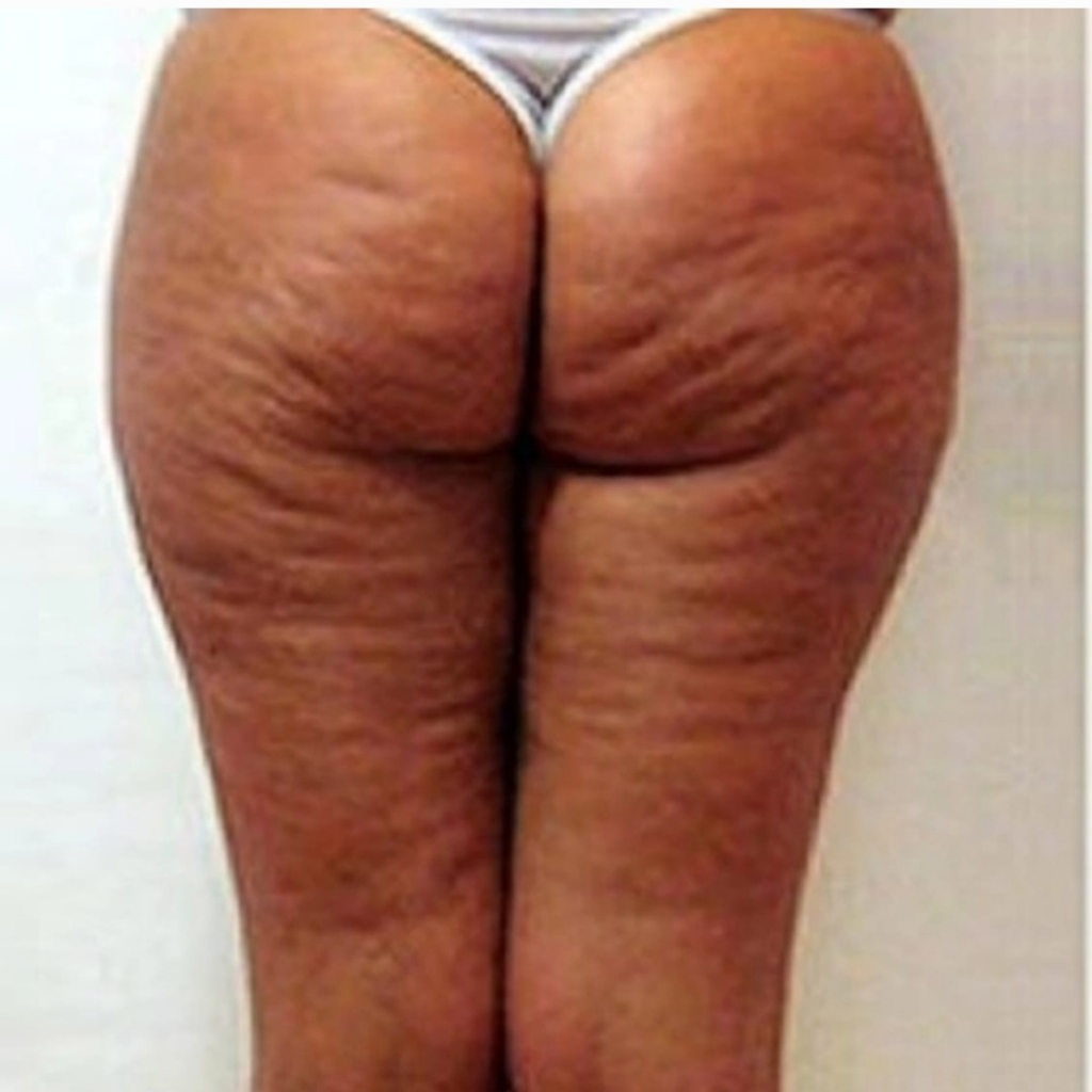 Коррекция тела 1.5 часа