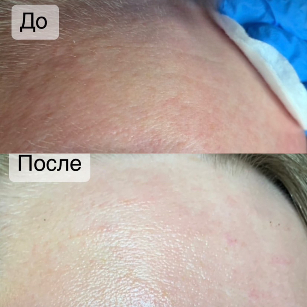 Увлажнение кожи