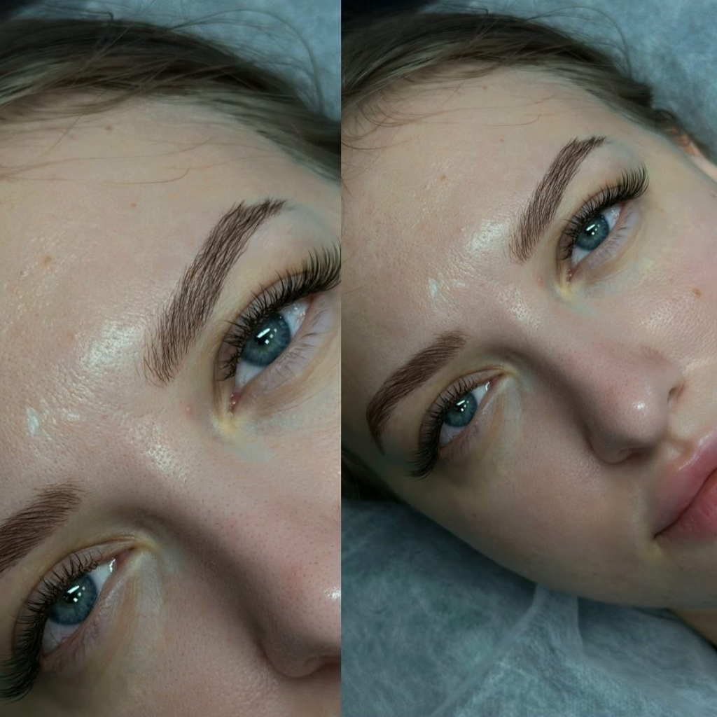 Наращивание ресниц  Классика