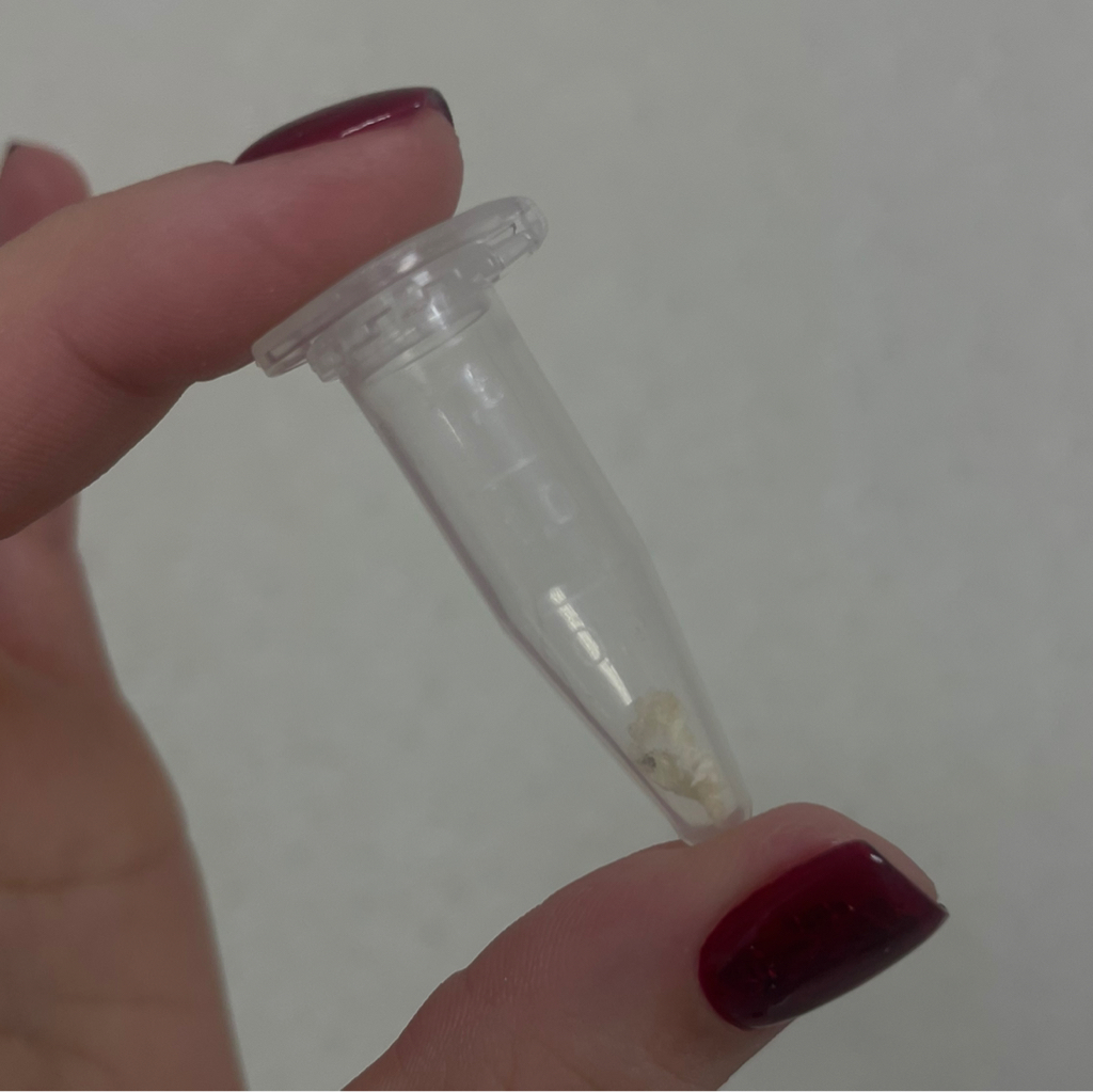 Сбор материала на анализ (грибок ногтей)