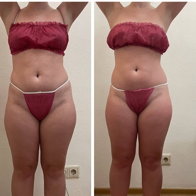 ЭКСПРЕСС стрийность