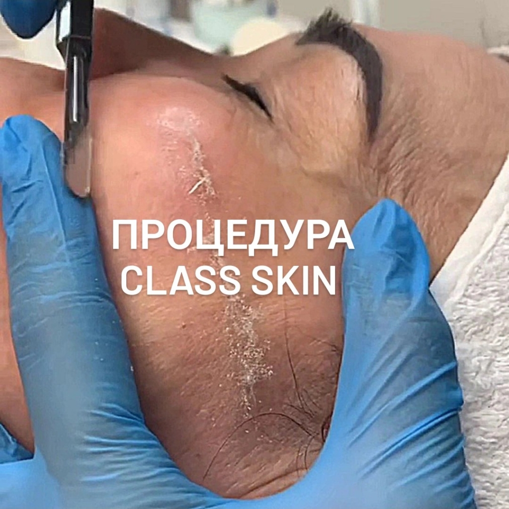 Гласс Скин (Стеклянная Кожа)