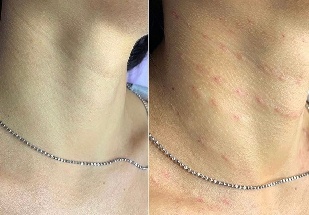 Заполнение колец Венеры