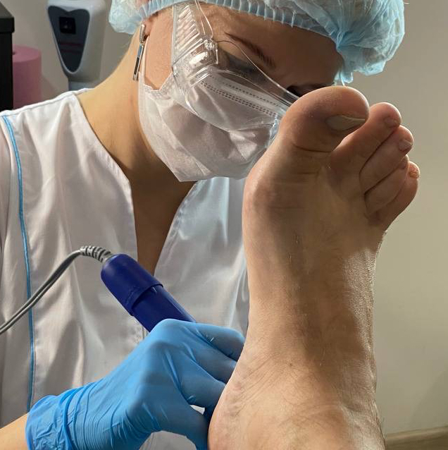 Мужской аппаратный педикюр