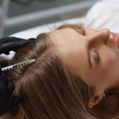 Фракционная мезотерапия волос