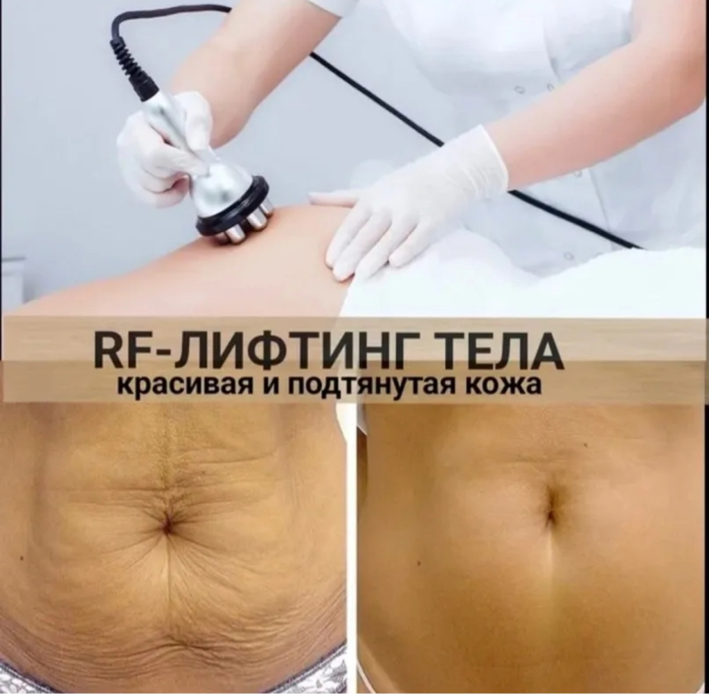 RF-лифтинг тела абонемент ( от 5 процедур) 1200 р , разовое 1500 р