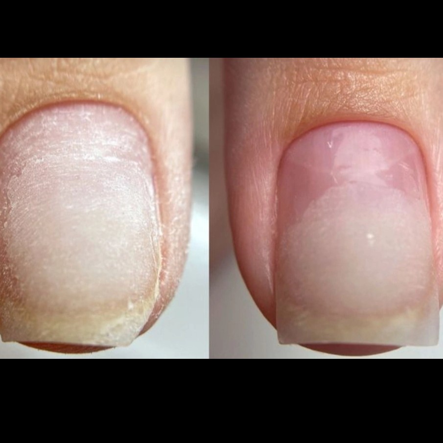 Ремонт ногтей