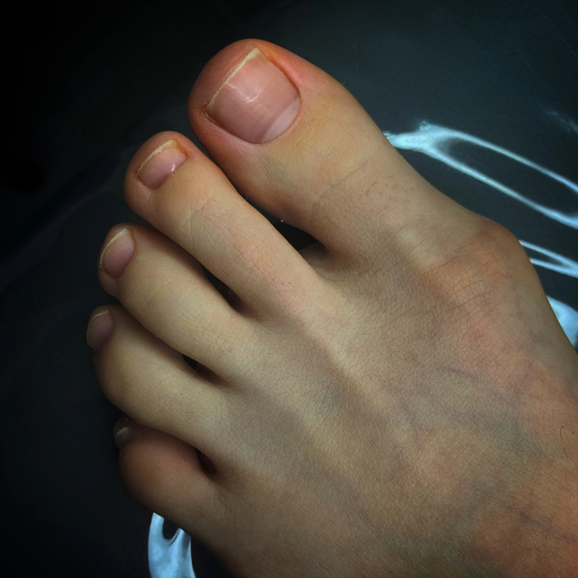 Обработка пальчиков эстетика