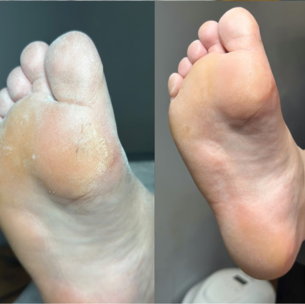 Педикюр полная обработка