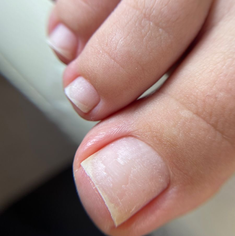 Обработка пальцев без покрытия педикюр