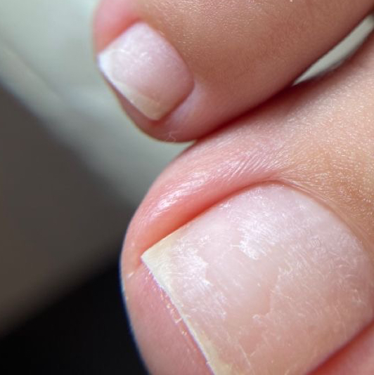 Обработка стоп и пальчиков без покрытия