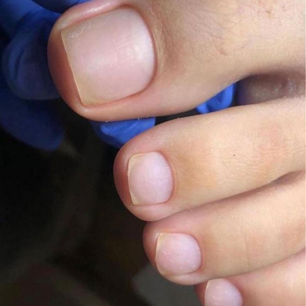 Педикюр (пальчики + пятки)