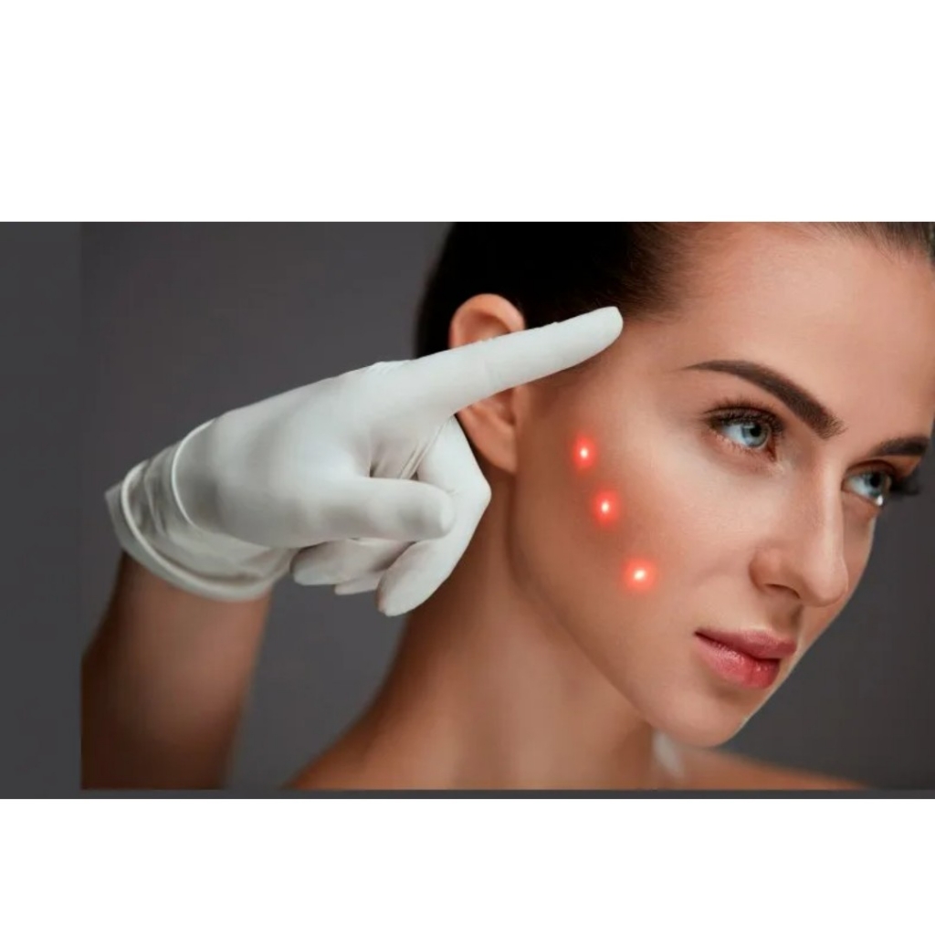 tratamiento anti arrugas inyectable