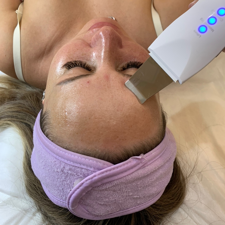 Ультразвуковая чистка лица