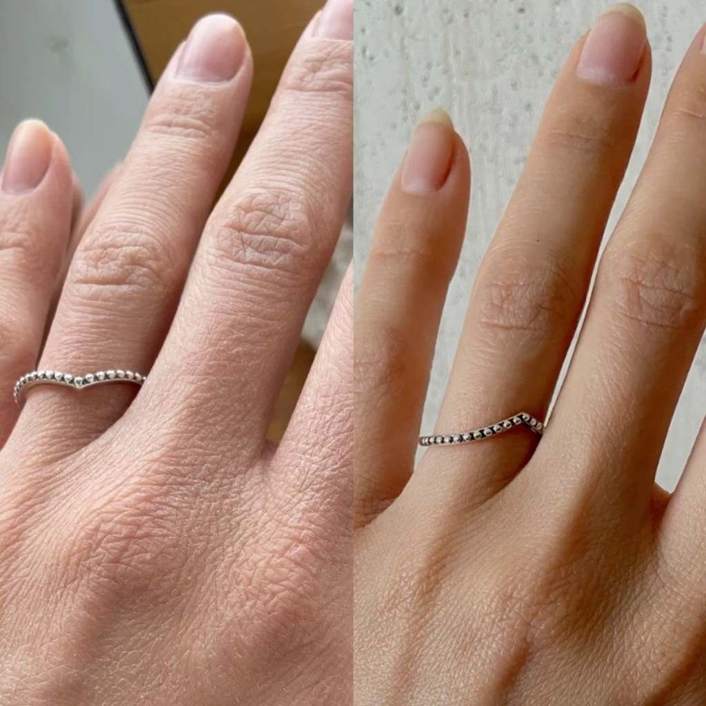 Парафинотерапия рук