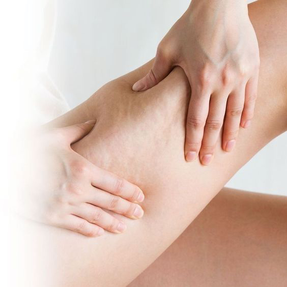 Антицеллюлитный массаж тела (только женский)