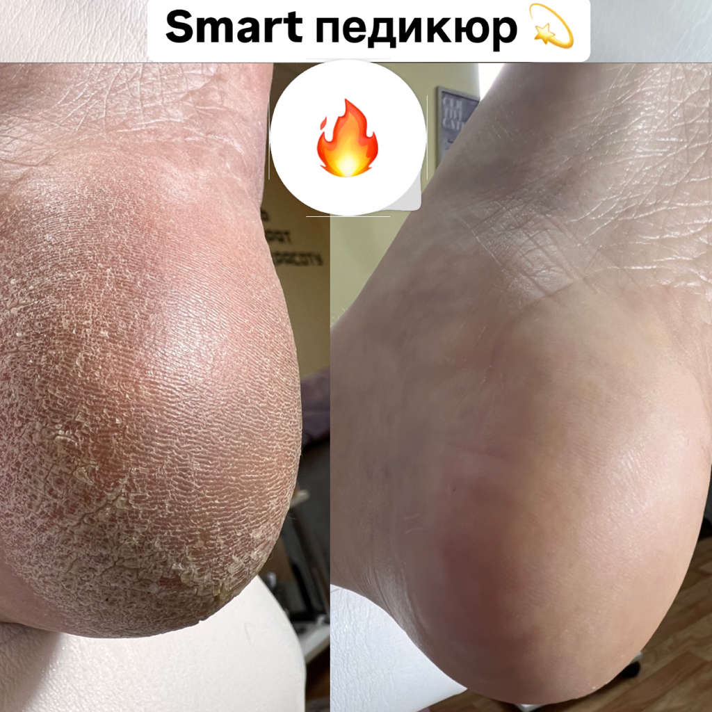 Smart Педикюр с обработкой стоп и покрытие гель лак