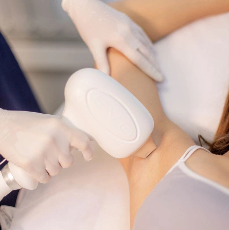 Лазерная эпиляция  Подмышки