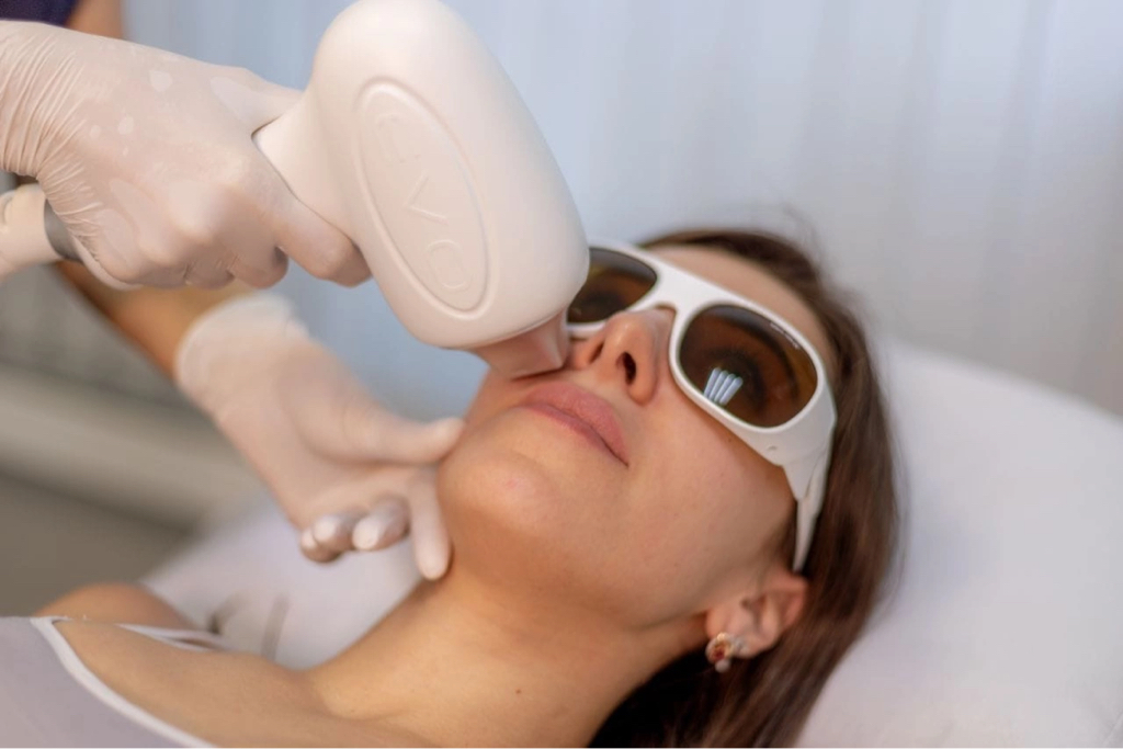 Верхняя губа