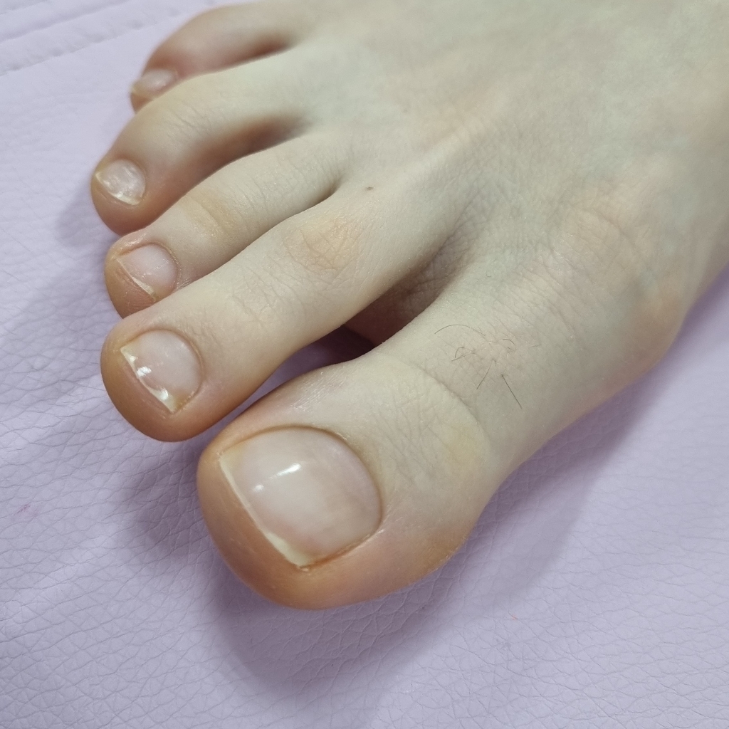 Педикюр аппаратный/комбинированный