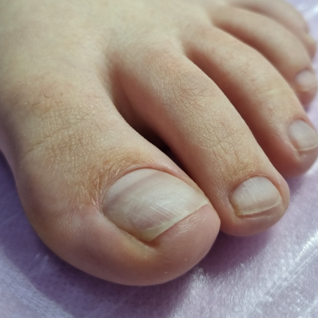 Педикюр пальчики