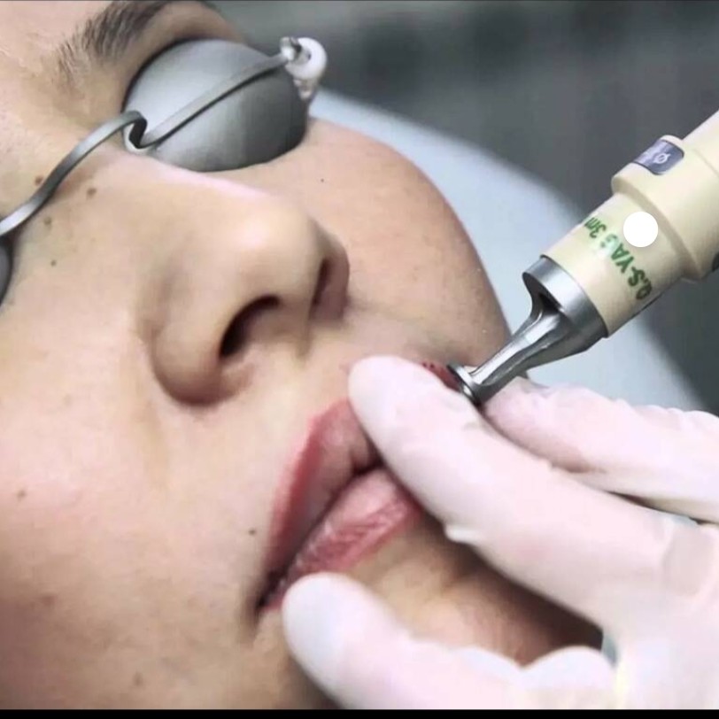 Eliminación de permanente de cejas o labios