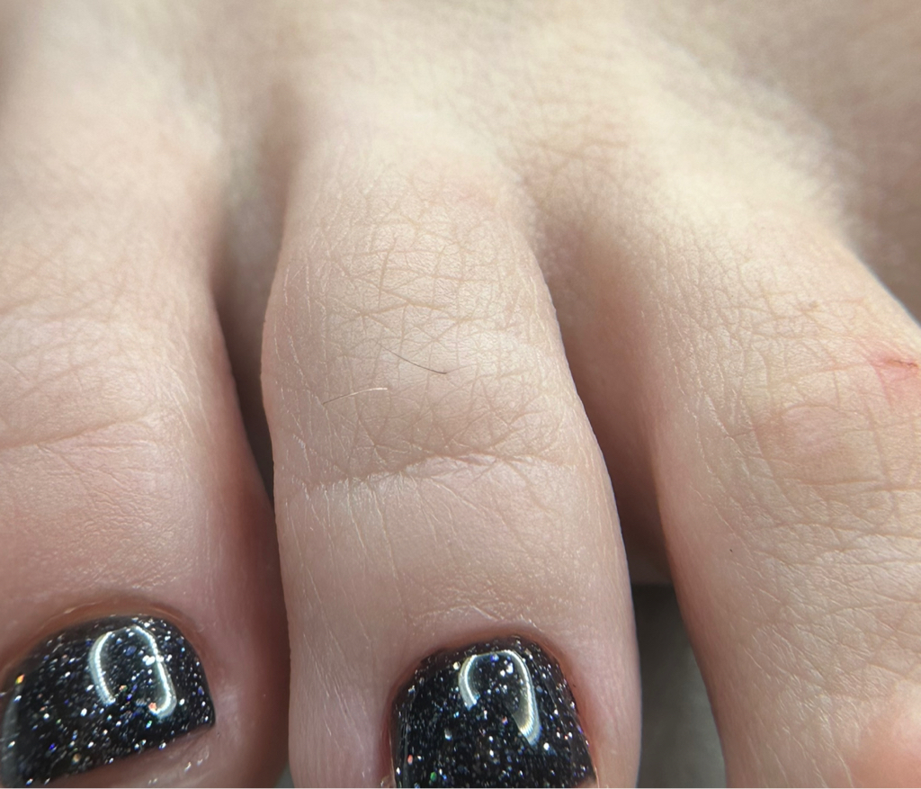 Обработка пальцев ног с покрытием гель-лак