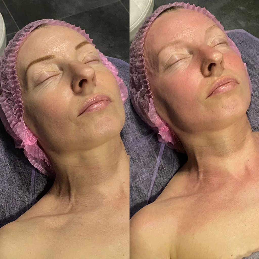 Массаж лица