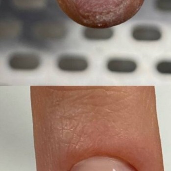 Наращивание 1 ногтя