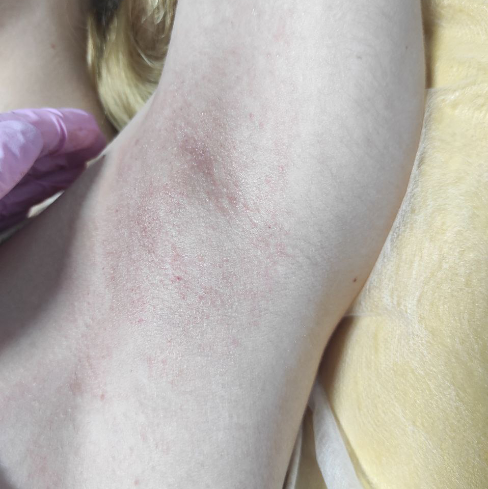 Бикини глубокое+ножки полностью+подмышки