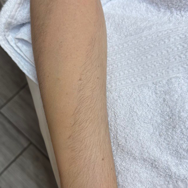 Руки до локтя