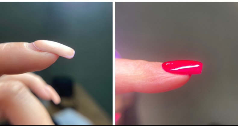 Ремонт одного ногтя