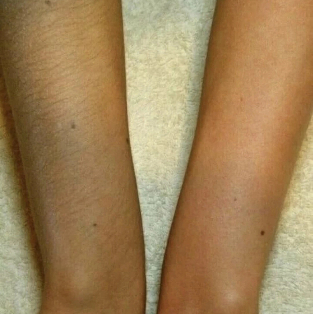 Руки полностью