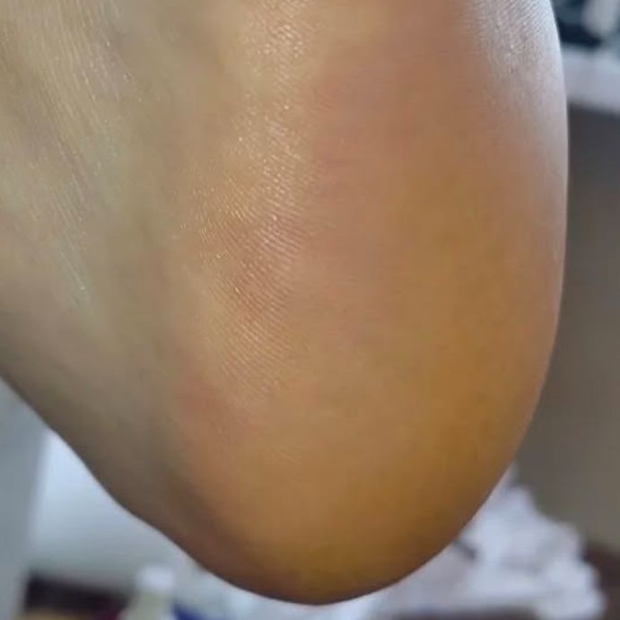 Мужской аппаратный педикюр