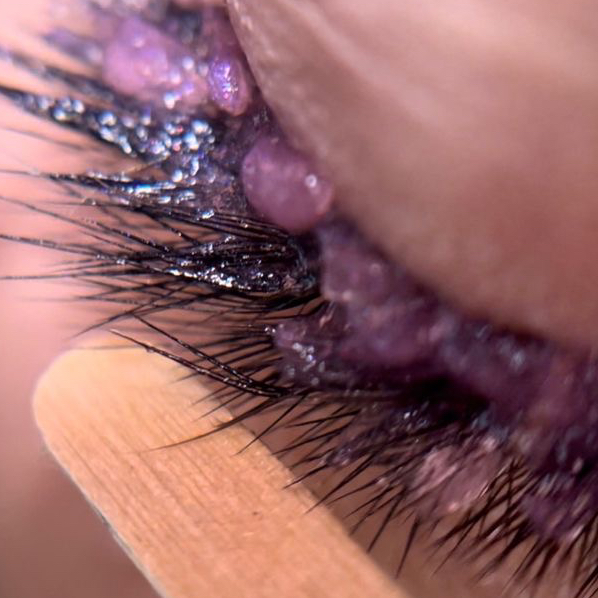 Снятие наращенных ресниц