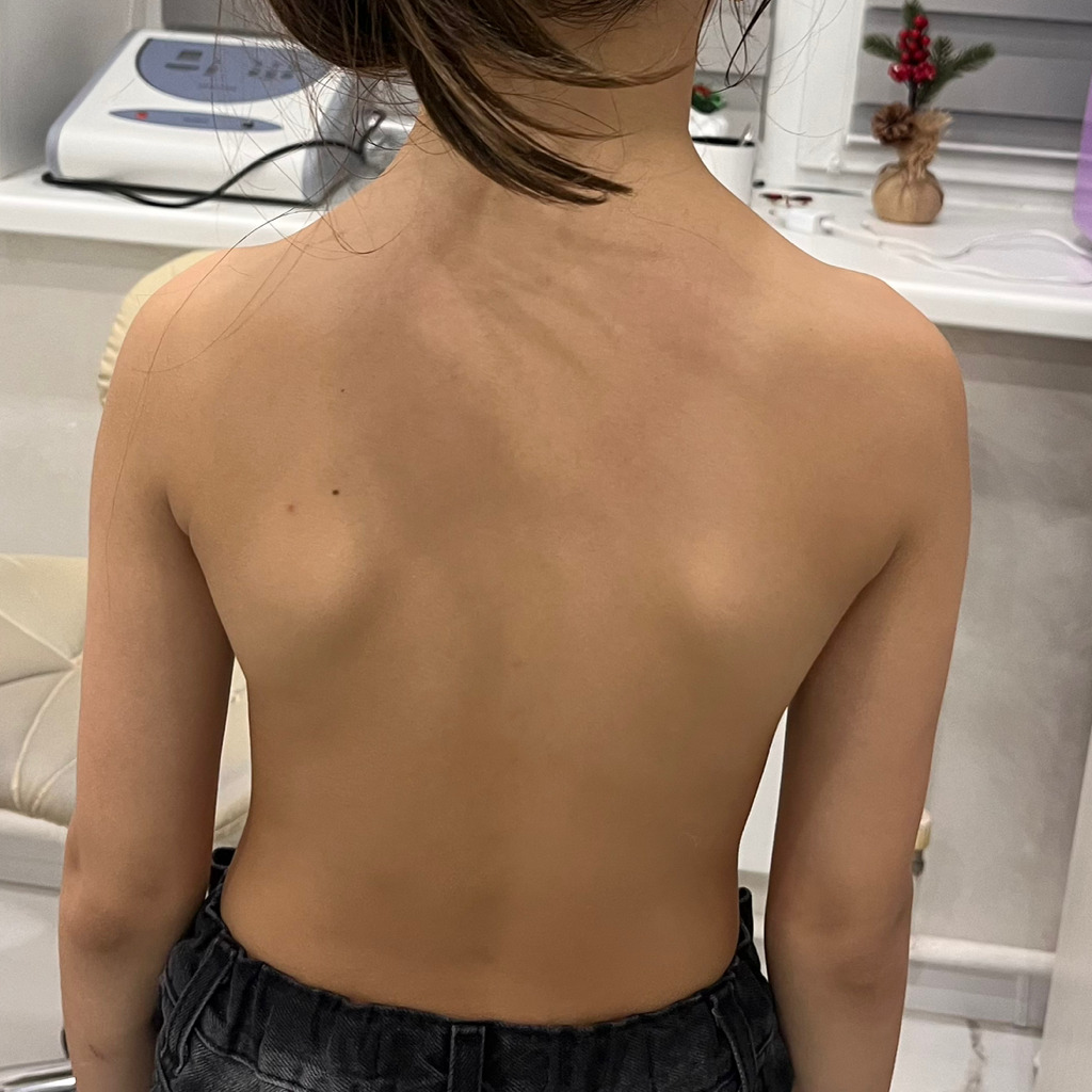 Массаж спины