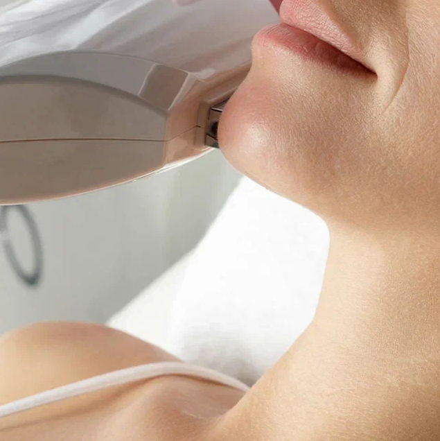 Элос-омоложение кожи. Фотоомоложение. IPL - терапия. Шея