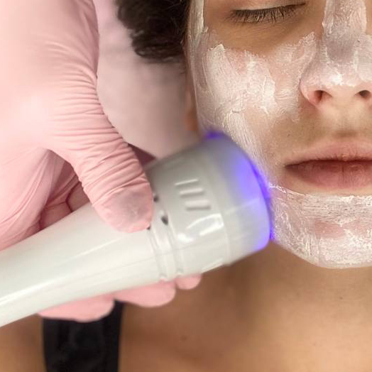 Криотерапия