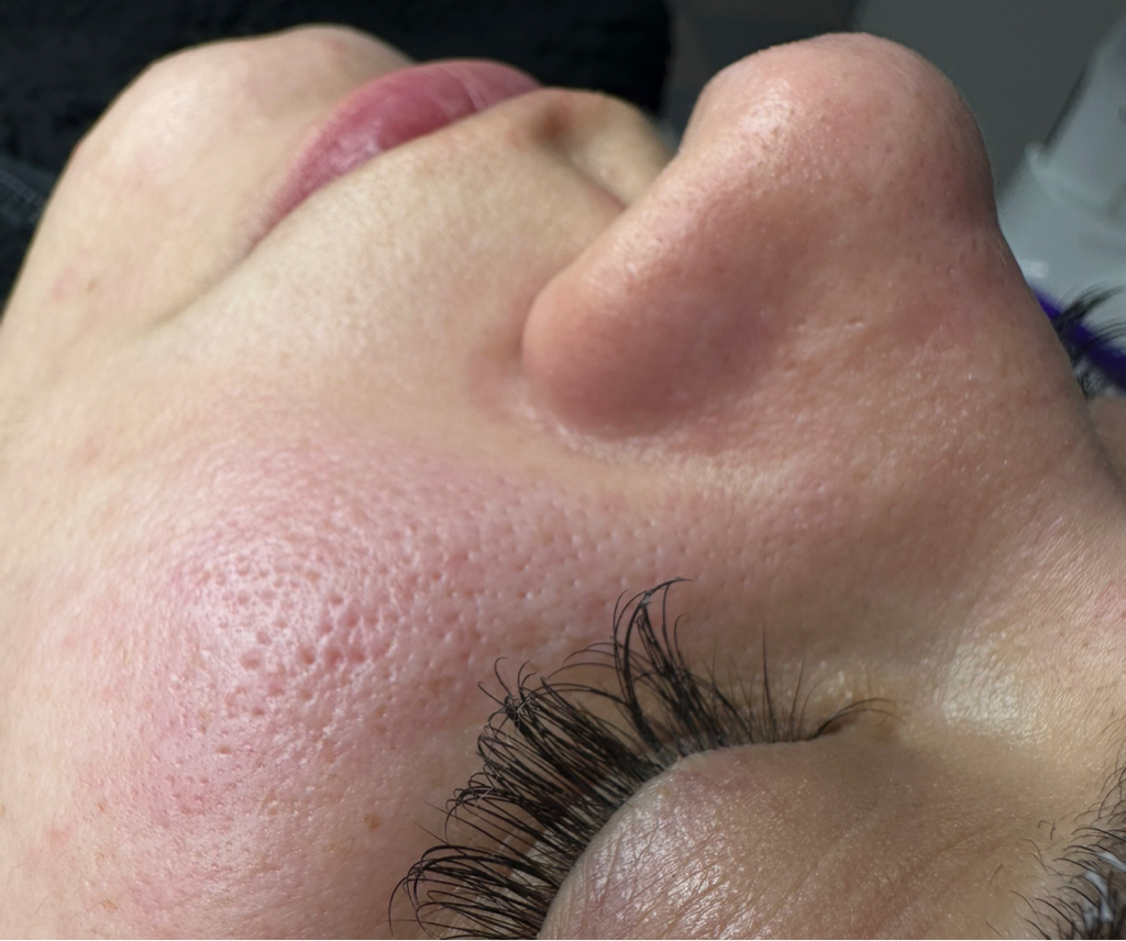 Чистка лица+ пилинг + криотерапия + фонофорез + альгинатная маска