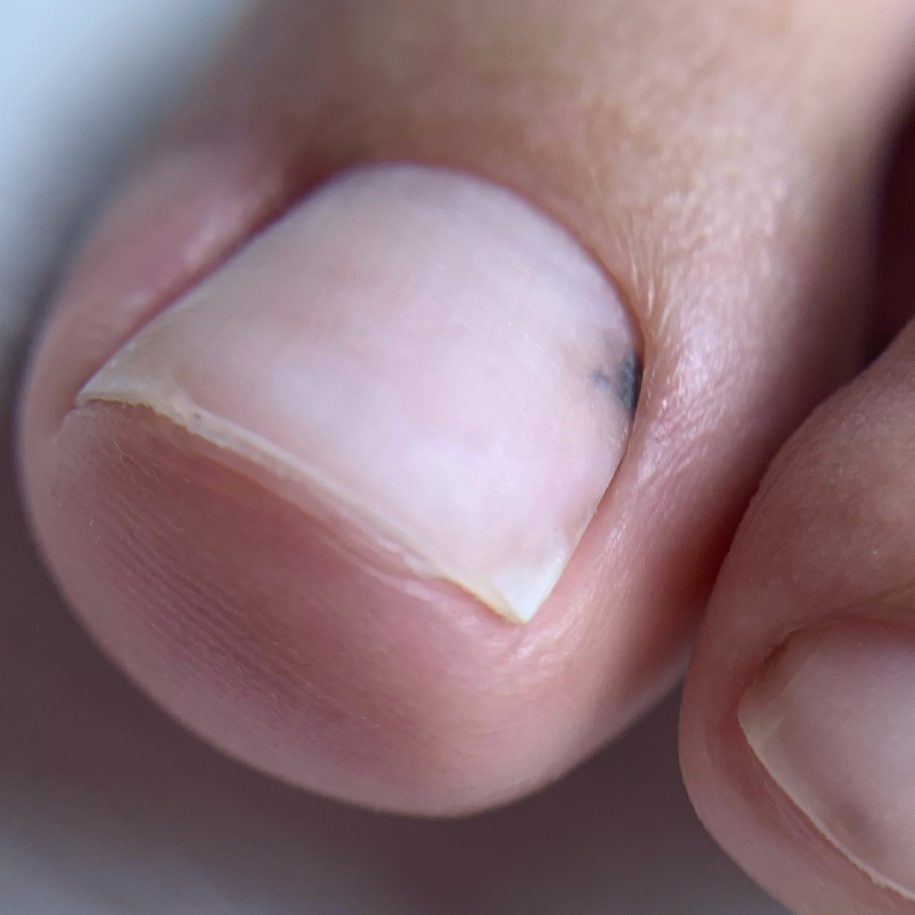 Аппаратная обработка пальчиков без покрытия